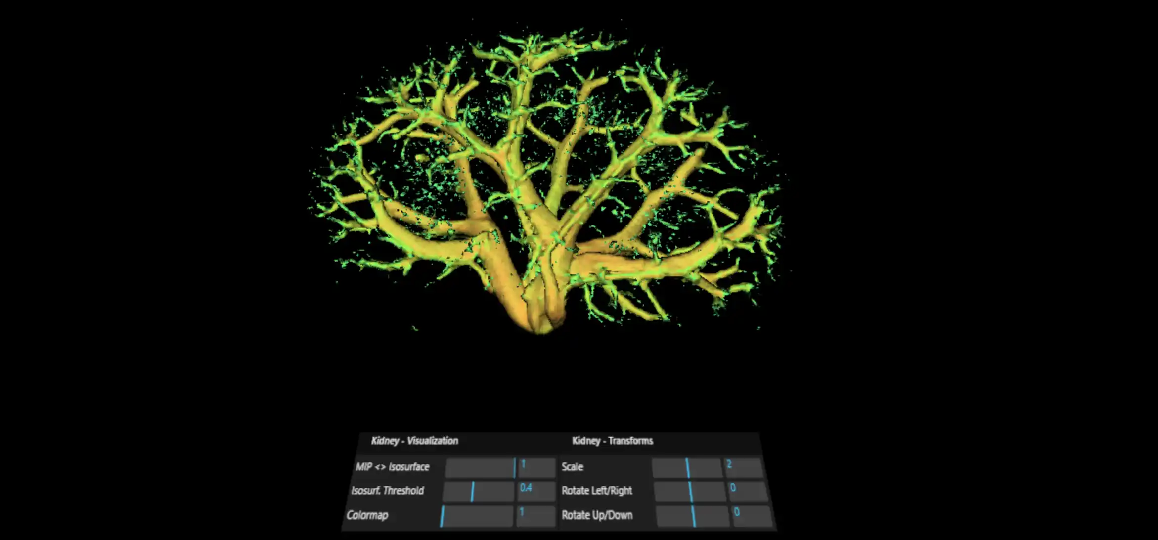 Interactive VR Organ Viewer